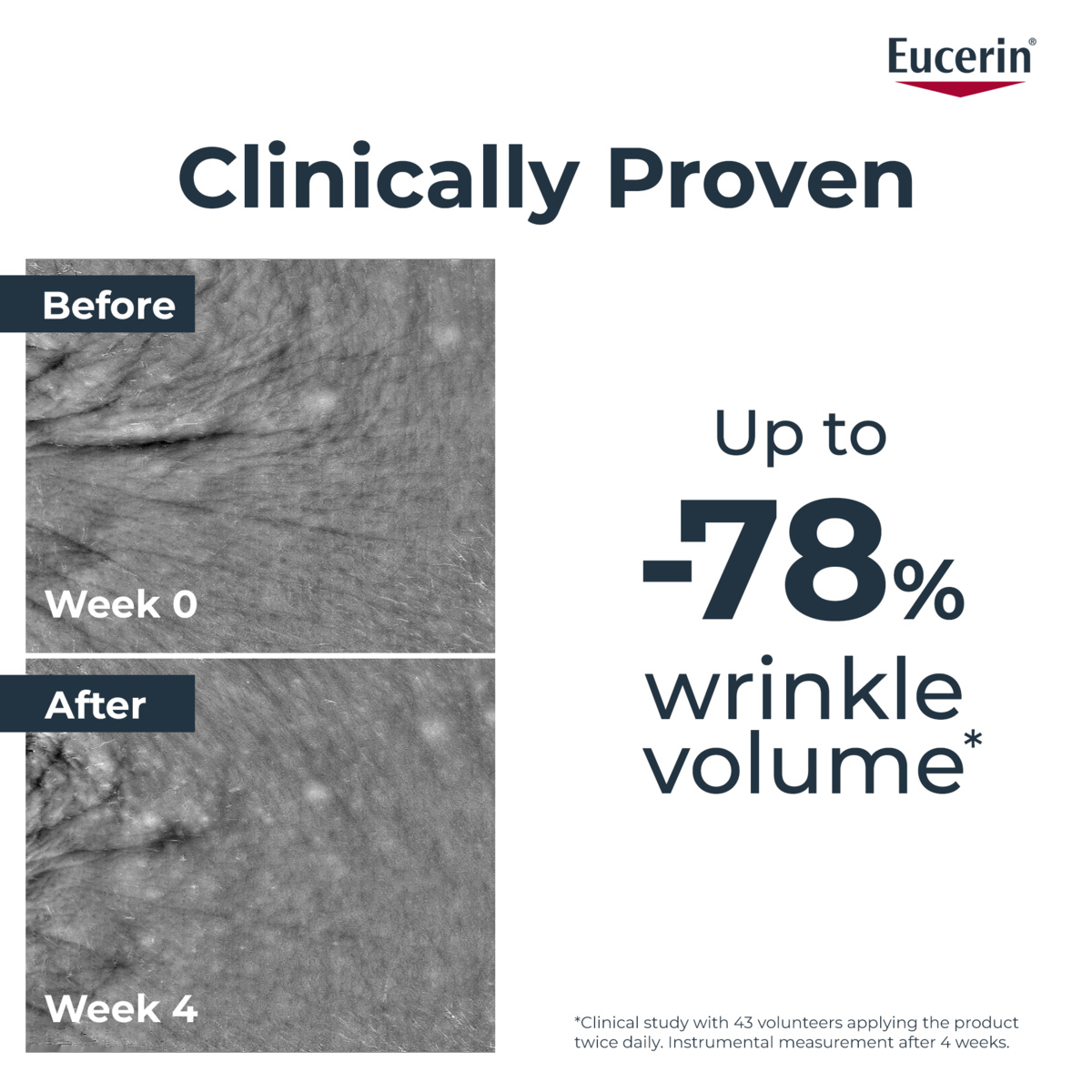 Reduced wrinkles after using EUCERIN Epicelline Serum