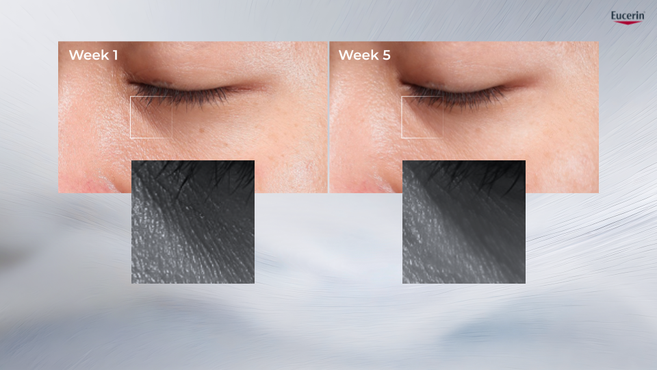 Ernie Zakri's skin test results after using Eucerin Epicelline® Serum