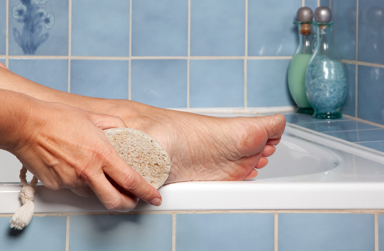 Use gentle scrub or pumice stone to buff dead skin