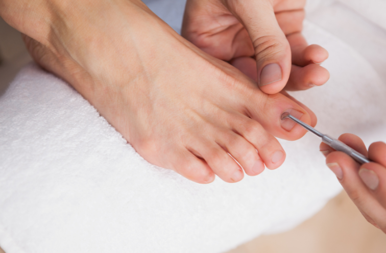 Keep toenails clean and neat