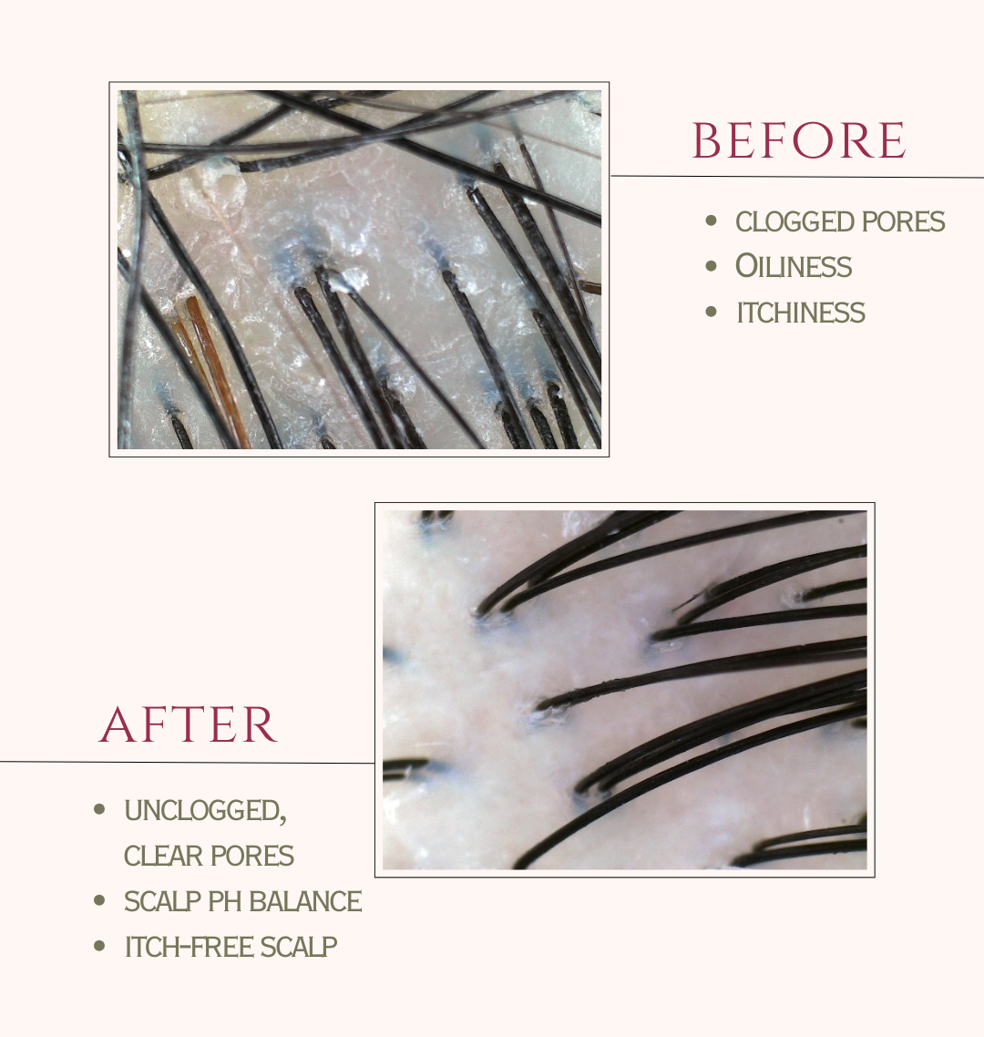 Vel's before & after scalp scans