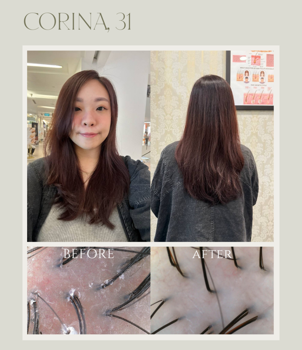 Corina's before & after scalp scans