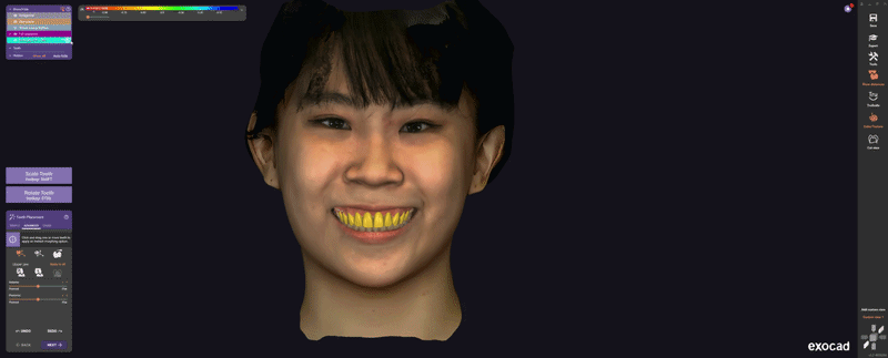 Designing my Smile Trial