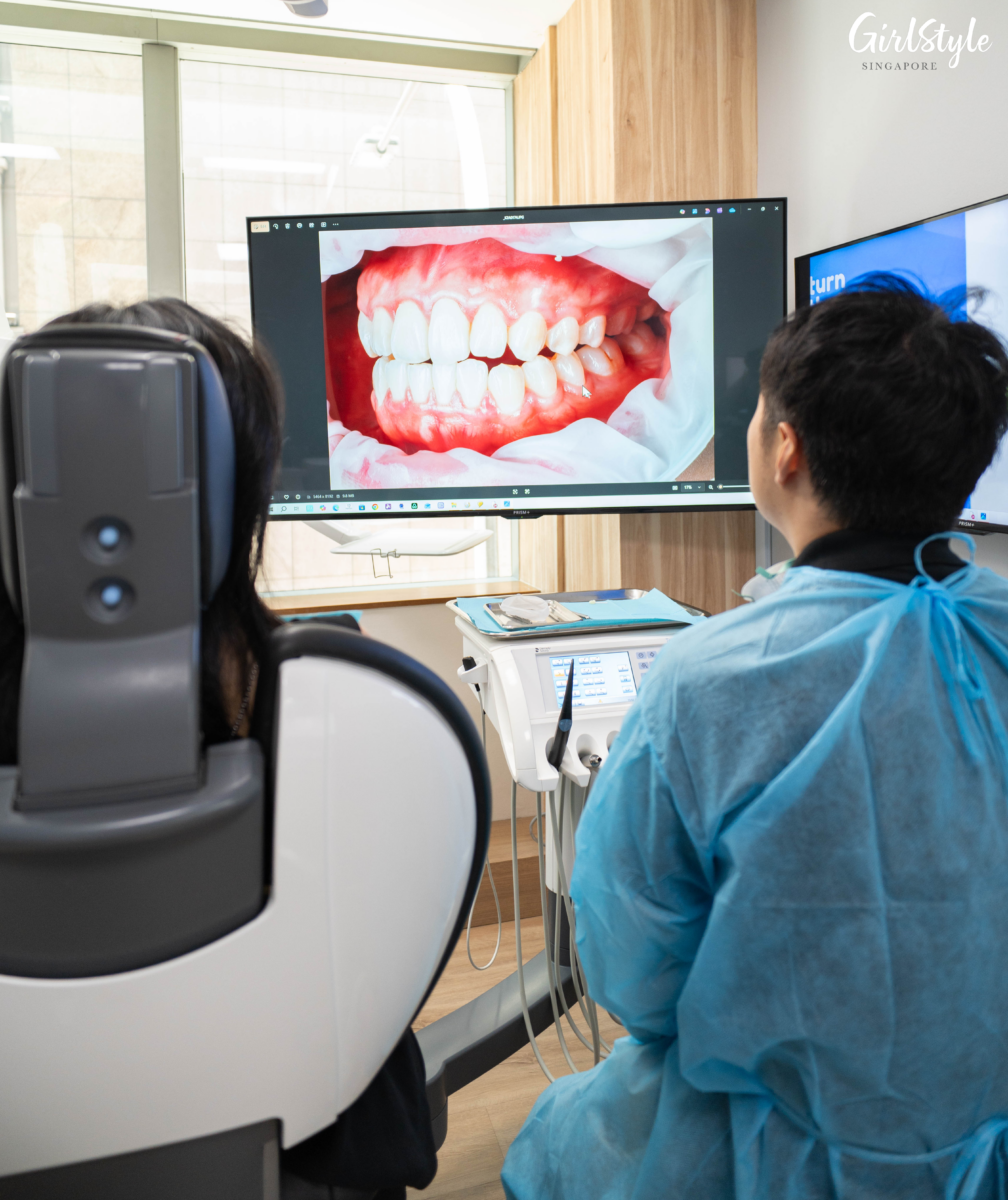 High-resolution photos of my teeth