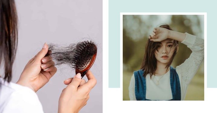 Hair Loss 101: Hide It With Short-Term Fixes Or Learn What’s The Cause And How To Resolve It?