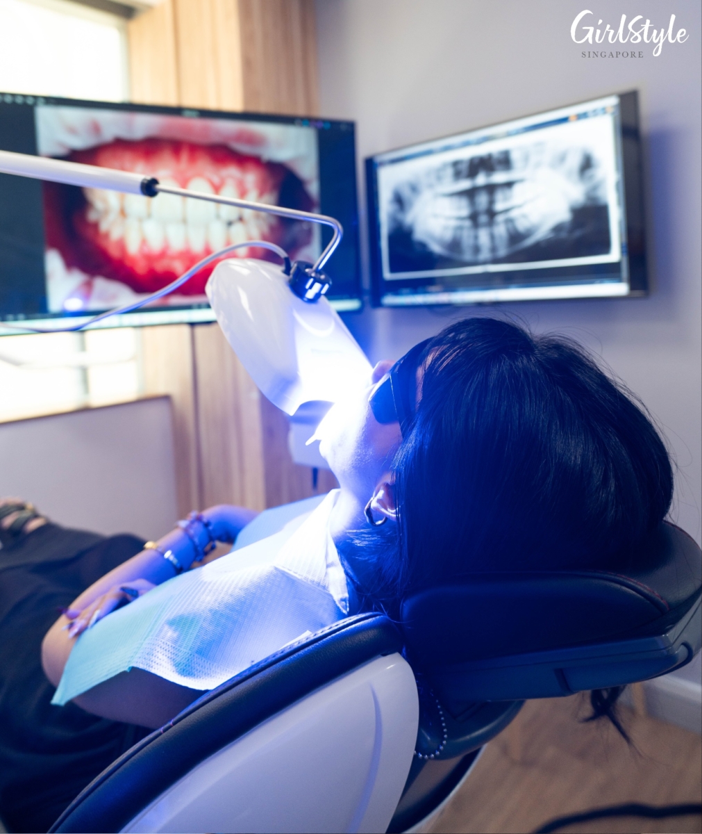 Blue light with WHITEN+ gel application at Dental Designs Clinic