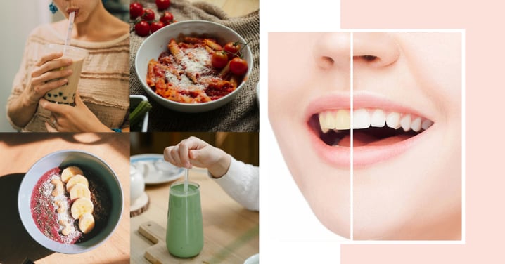 5 Trendy Food & Drinks You Might Not Know Are Staining Your Teeth And How To Fix It