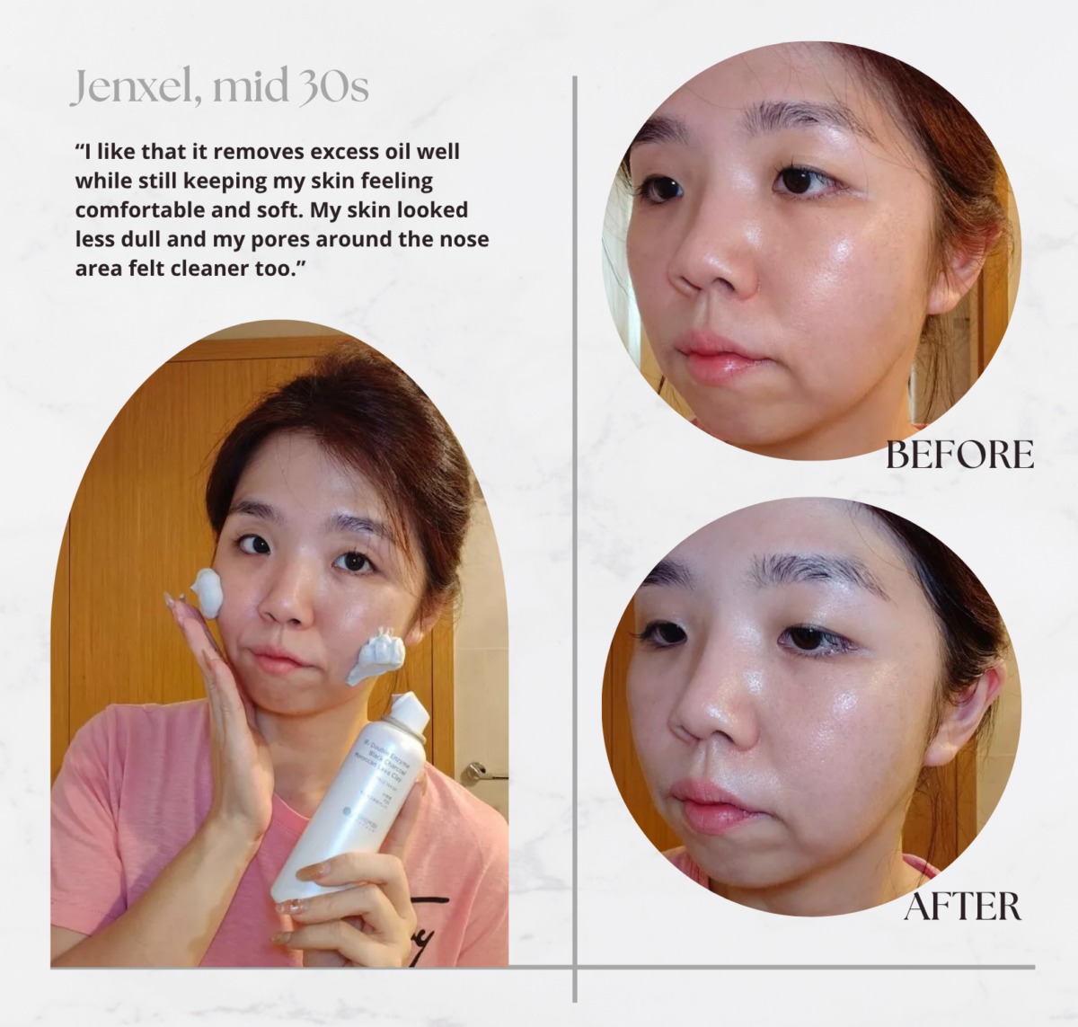 Jenxel's review and before & after using SHIMBI METHOD Double Enzyme, Black Charcoal, Moroccan Lava Clay Face Wash