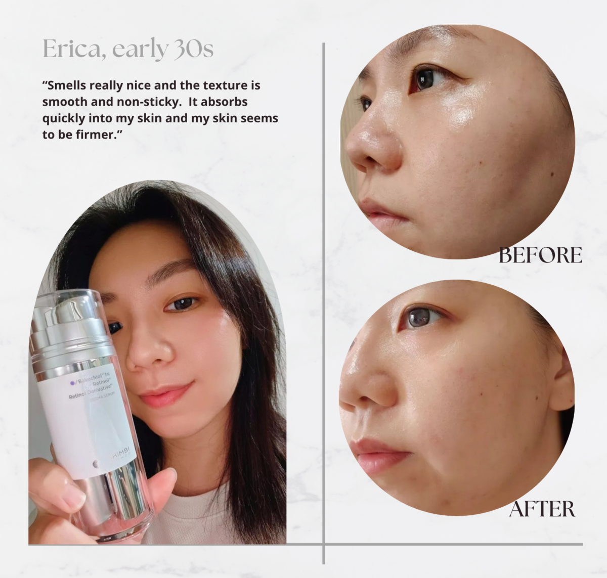 Erica's review and before & after using SHIMBI METHOD Bakuchiol 1%, Retinol, Retinol Derivative Derma Serum