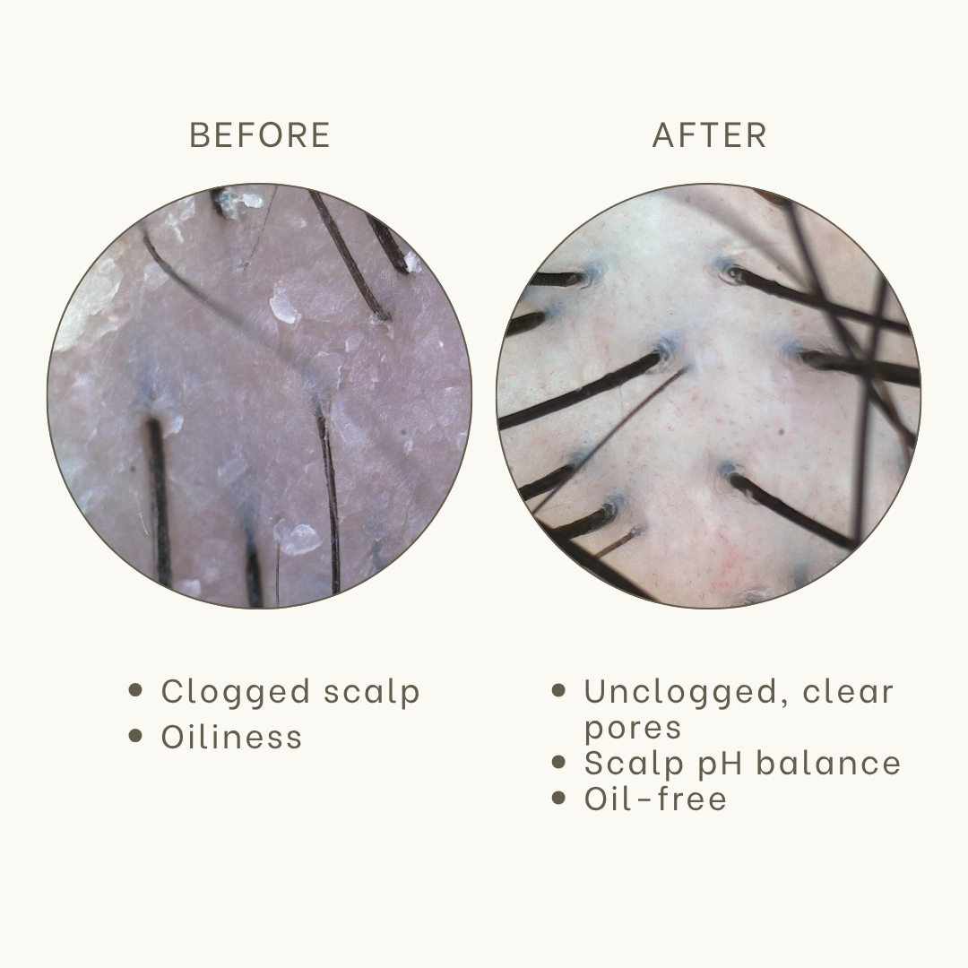 Scalp scans before and after TK TrichoKare’s Exosome Scalp Renewal Therapy
