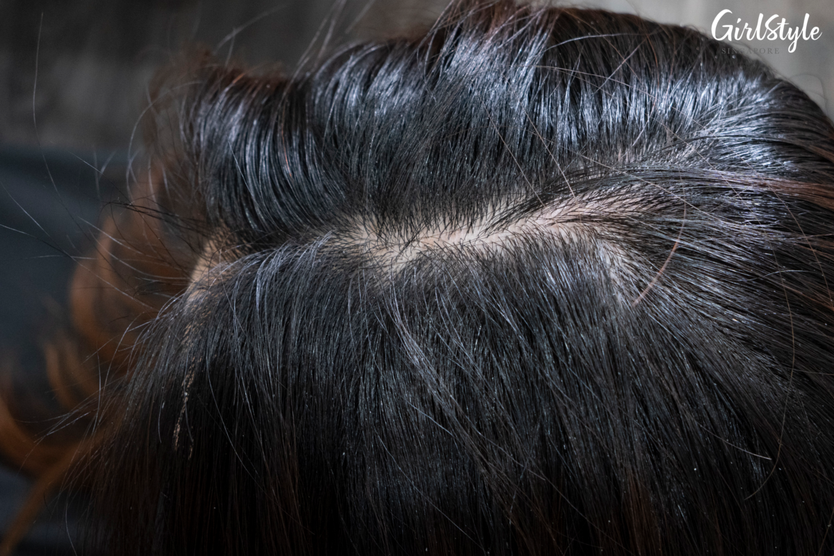 Kristy's widening hair part
